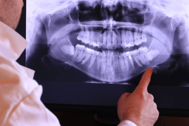 Best Dental Abscess Treatment in Plains, MT